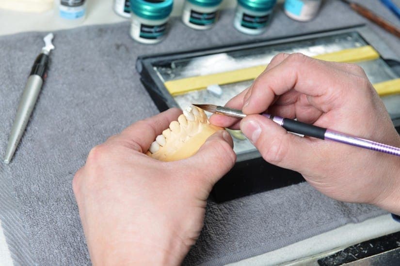 Tooth crown and porcelain veneers procedure