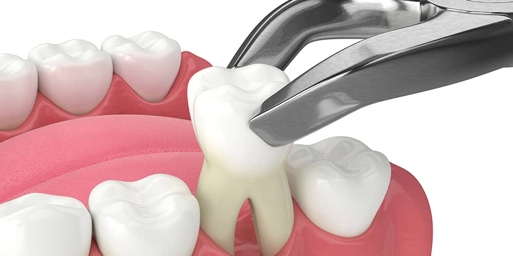 Patient receiving post-operative care instructions